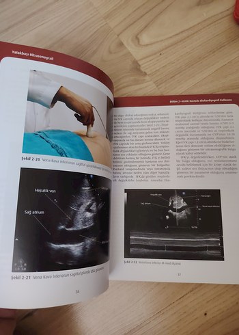 Yatakbaşı Ultrasonografi Kitabı - Görsel 2