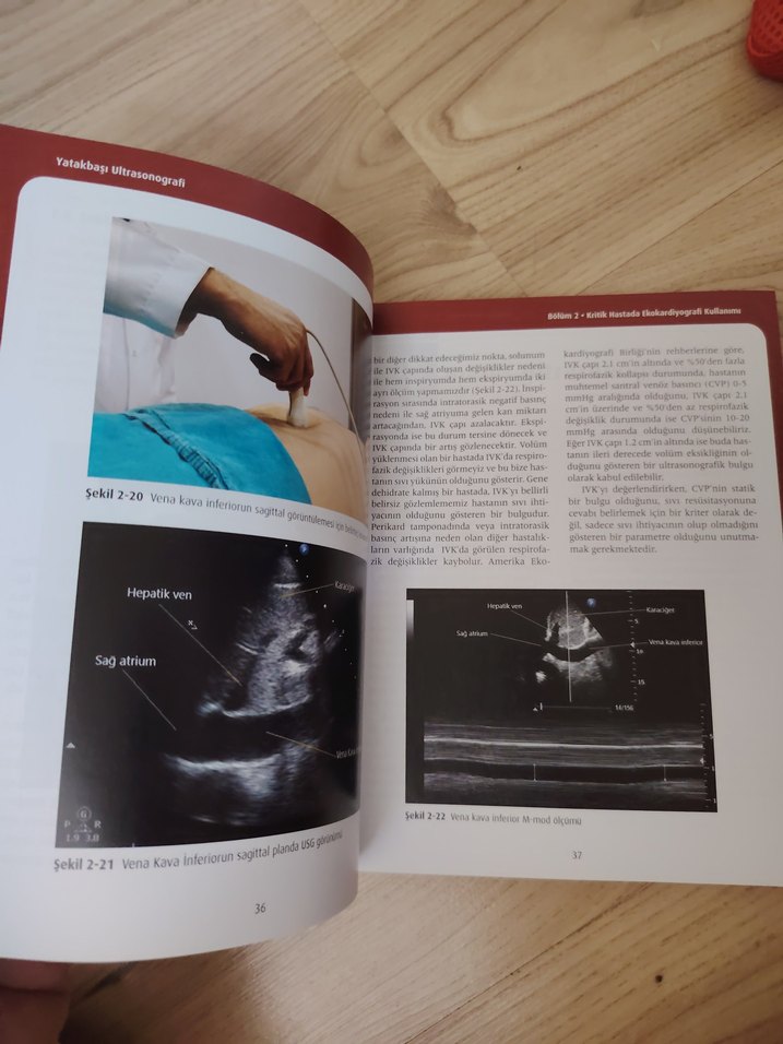 Yatakbaşı Ultrasonografi Kitabı - Görsel 2