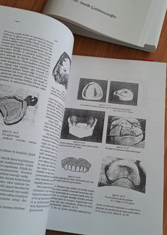 TAM PROTEZLER SENİH ÇALIKKOCAOĞLU Forokopi  TOTAL PROTEZ - Görsel 4