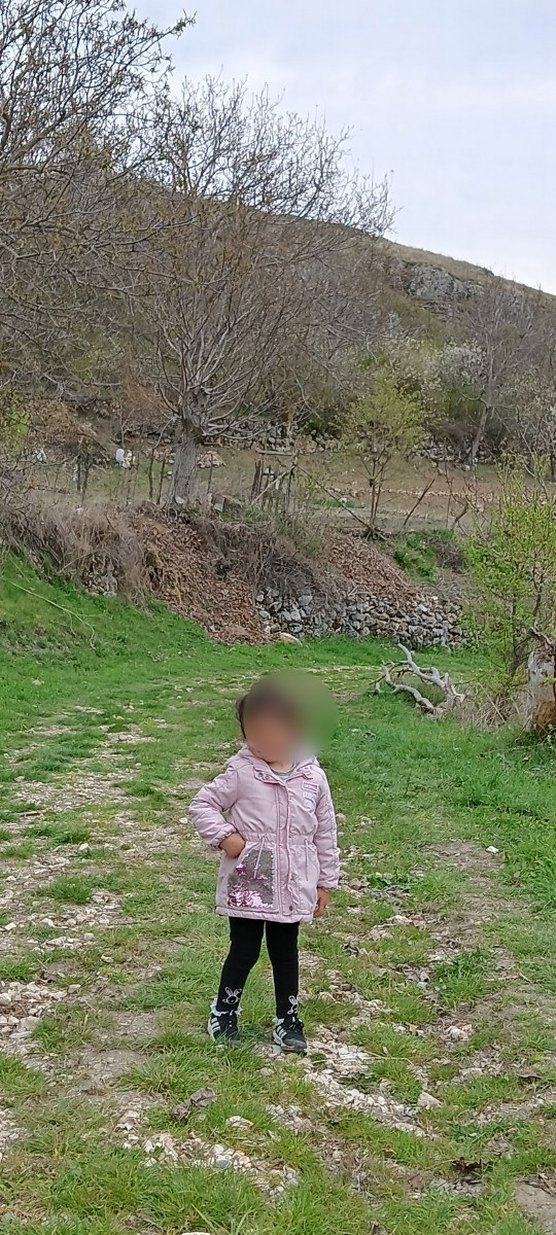 Kürklü Kapüşonlu Pembe Kız Çocuk Mont - Görsel 2