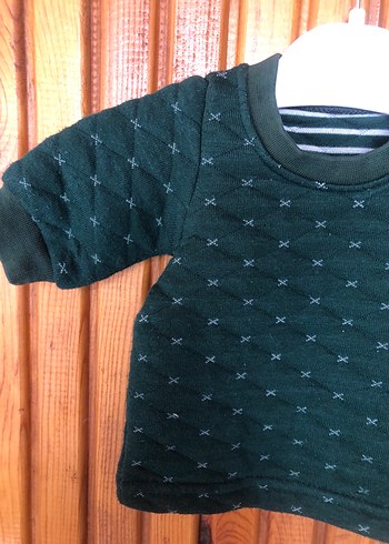 Bebek body - Görsel 2