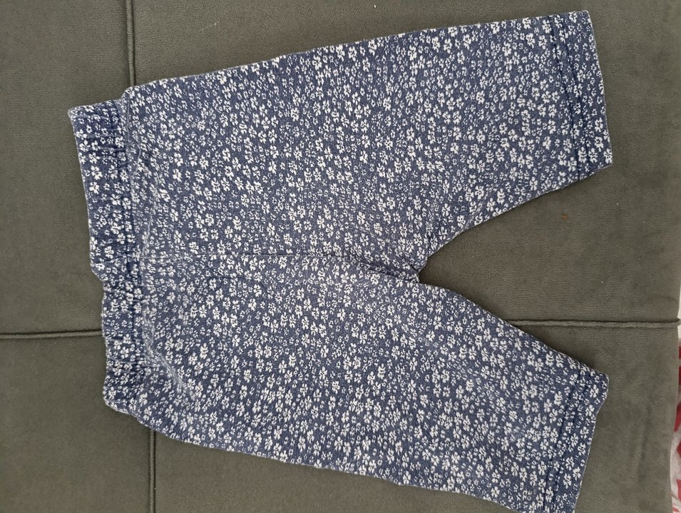 Düğmeli Mavi Bebek şortu - Görsel 2