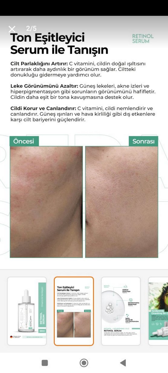 KEIN Retinol Serum Kadınlar İçin - Görsel 5