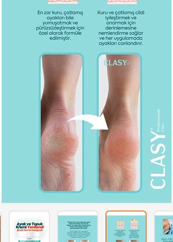 Diğer CLASY Ayak ve Topuk Kremi 100 ml