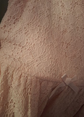 Pembe Dantel Detaylı Kız Elbisesi - Görsel 3