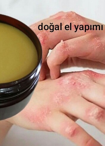 Diğer