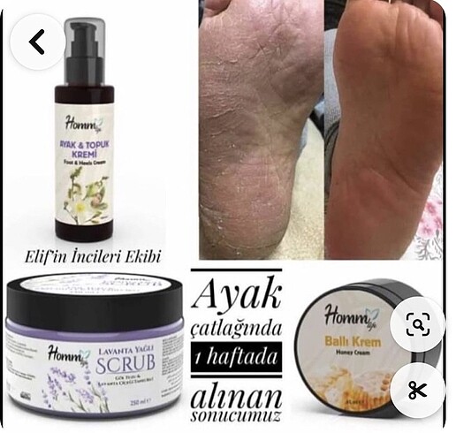 Ayak çatlakları