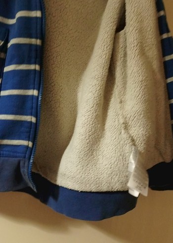 Mavi Çizgili Fermuarlı Erkek Çocuk Ceket - Görsel 2