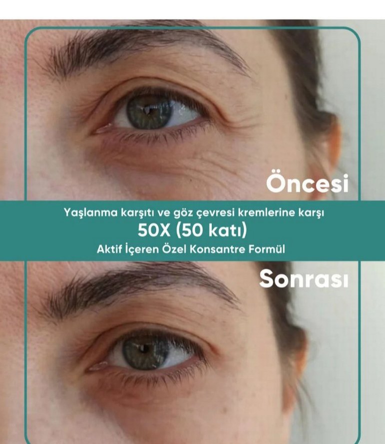 yeşilmarka tripple effect krem - Görsel 3