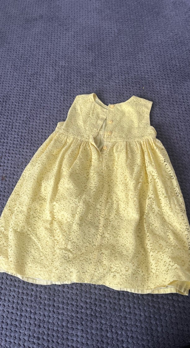 Sarı Dantelli Kız Elbise - Görsel 3