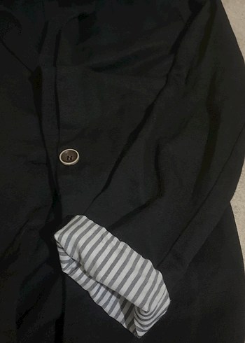 Düğmeli Siyah Midi Ceket - Görsel 2