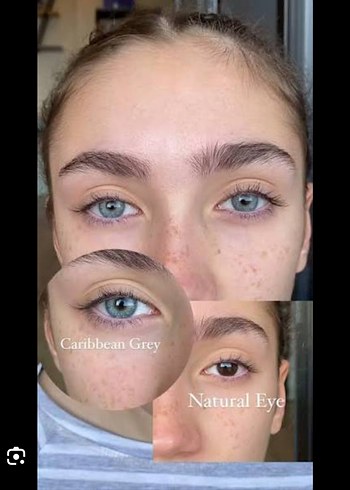 TTDEYE HYPNOSE -5 Miyop - Görsel 6