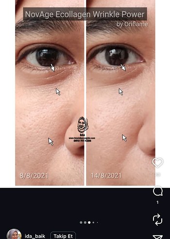 Novage+ Kırışıklık Karşıtı Cilt Bakım Seti - Görsel 4