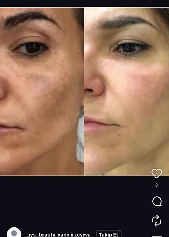 Novage+ Kırışıklık Karşıtı Cilt Bakım Seti - Görsel 7