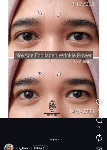 Novage+ Kırışıklık Karşıtı Cilt Bakım Seti - Görsel 3