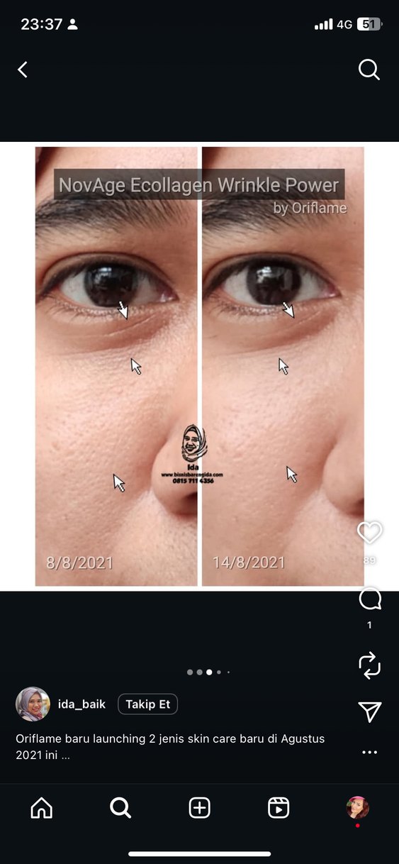 Novage+ Kırışıklık Karşıtı Cilt Bakım Seti - Görsel 4