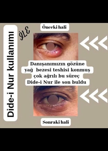 Dide-i Nur - Görsel 5