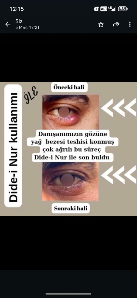 Dide-i Nur - Görsel 5