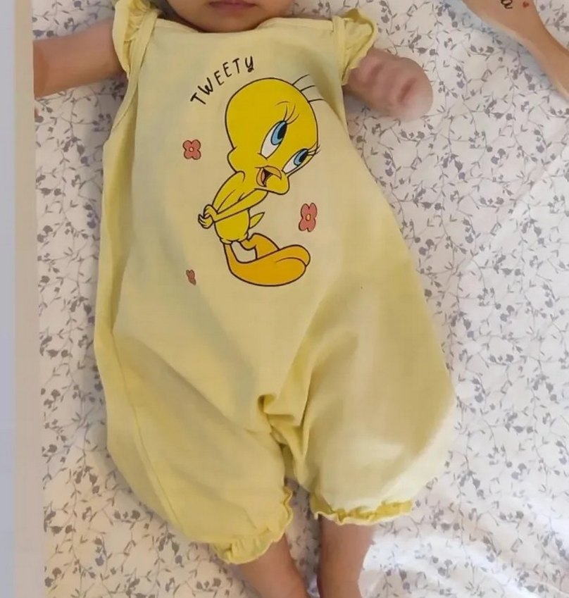 Beyaz Kabartmalı Baskılı Bebek Kız Tulumu - Görsel 4