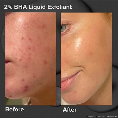  Beden Paulas choice bha liquid ve mandelic acid lactic acid