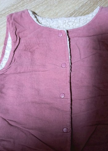 Kız Çocuk Pembe Keten Düğmeli Yelek - Görsel 2