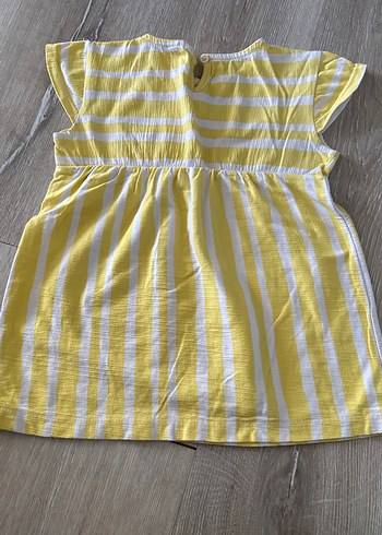 Sarı Nakışlı Kız Çocuk Elbise - Görsel 2