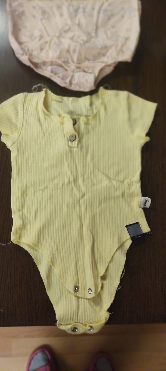 Sarı Bebek Kısa Kollu Düğmeli Body - Görsel 3