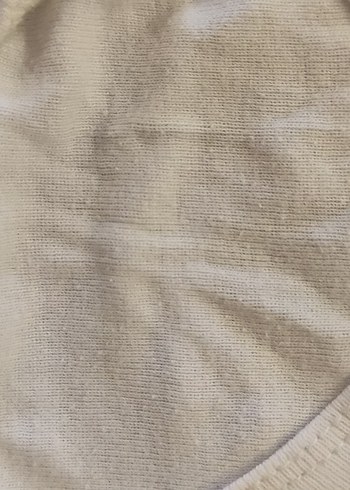 Sarı Düğmeli Askılı Bebek Çıtçıtlı Body - Görsel 4