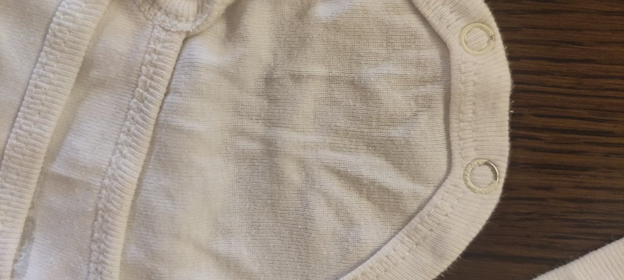 Sarı Düğmeli Askılı Bebek Çıtçıtlı Body - Görsel 4