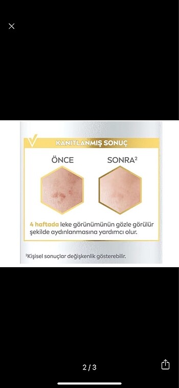 Nivea Nivea Luminous360 Leke Karşıtı Serum