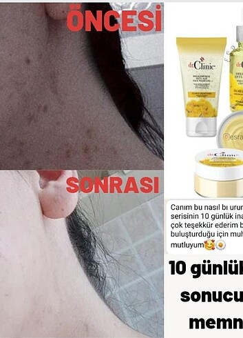 Beden Renk Ölmez çiçeği otu serisi