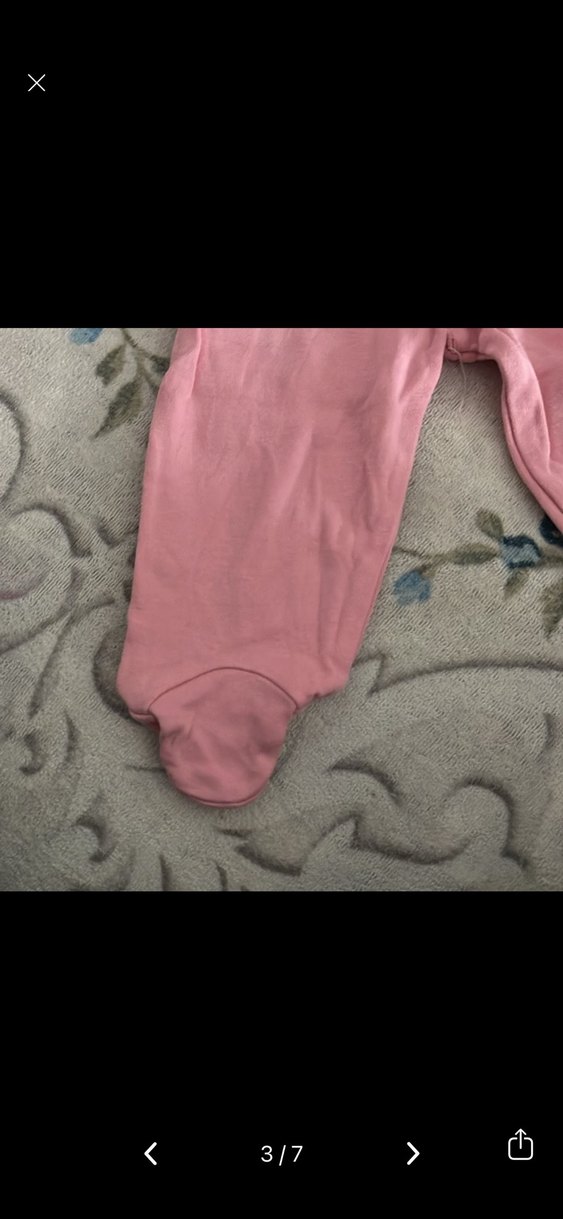 Dantel Detaylı Pembe Bebek Hastane Kıyafeti - Görsel 3