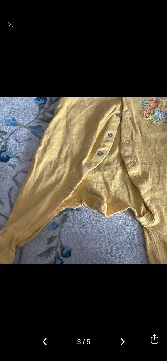 Sarı Düğmeli Bebek Tulum - Görsel 3