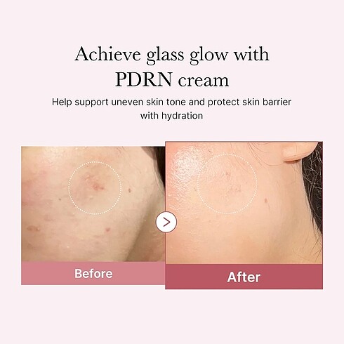 Diğer Medicube PDRN Pink Peptide Cream