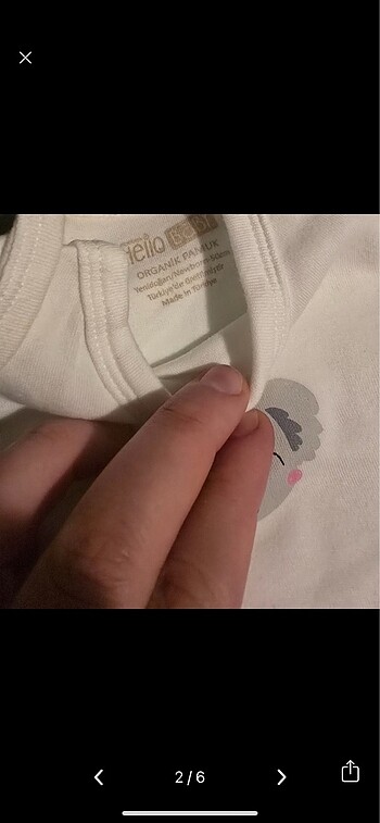 Hellobaby hastane çıkışı - Görsel 2