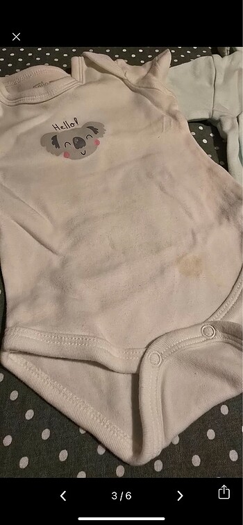 Hellobaby hastane çıkışı - Görsel 3