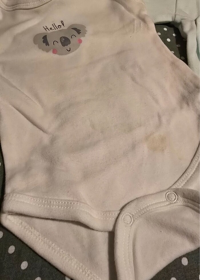 Hellobaby hastane çıkışı - Görsel 3