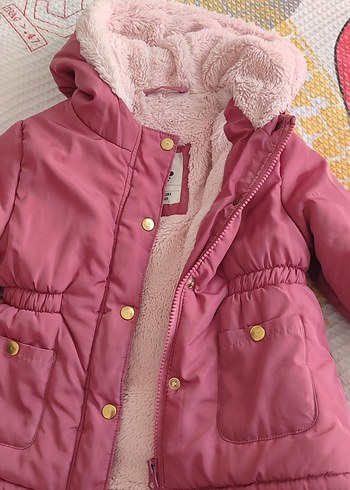 Düğmeli Pembe Kız Çocuk Mont