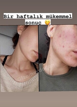 Diğer Keçi sütlü sabun