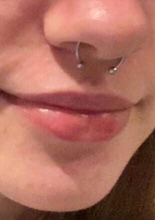 Mıknatıslı Septum