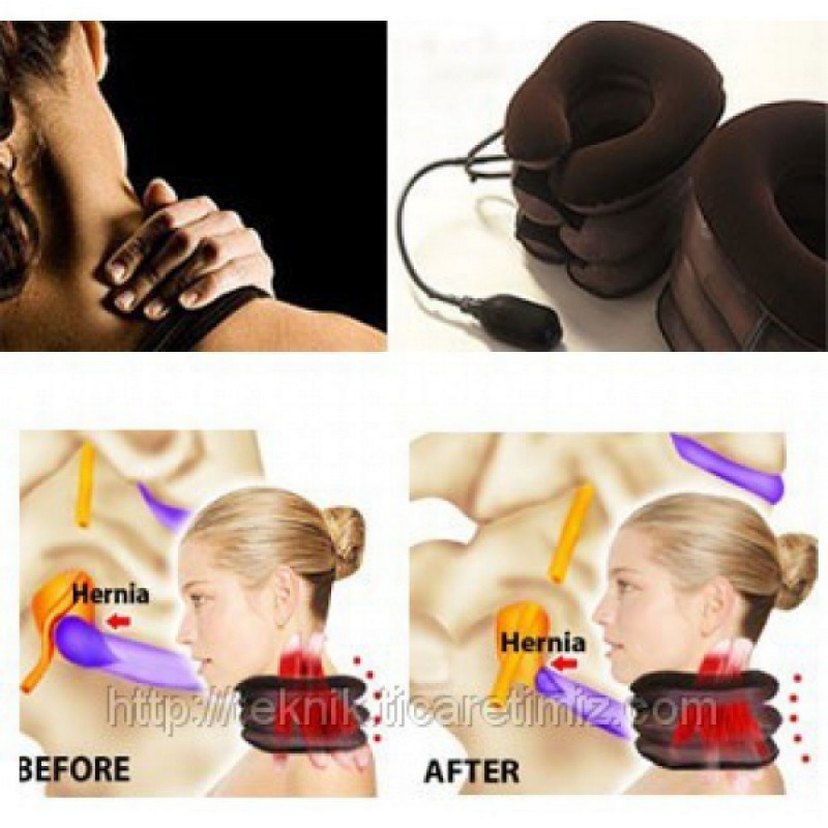 Ortapedik Şişirilebilir Boyun Destek Yastığı - Görsel 3