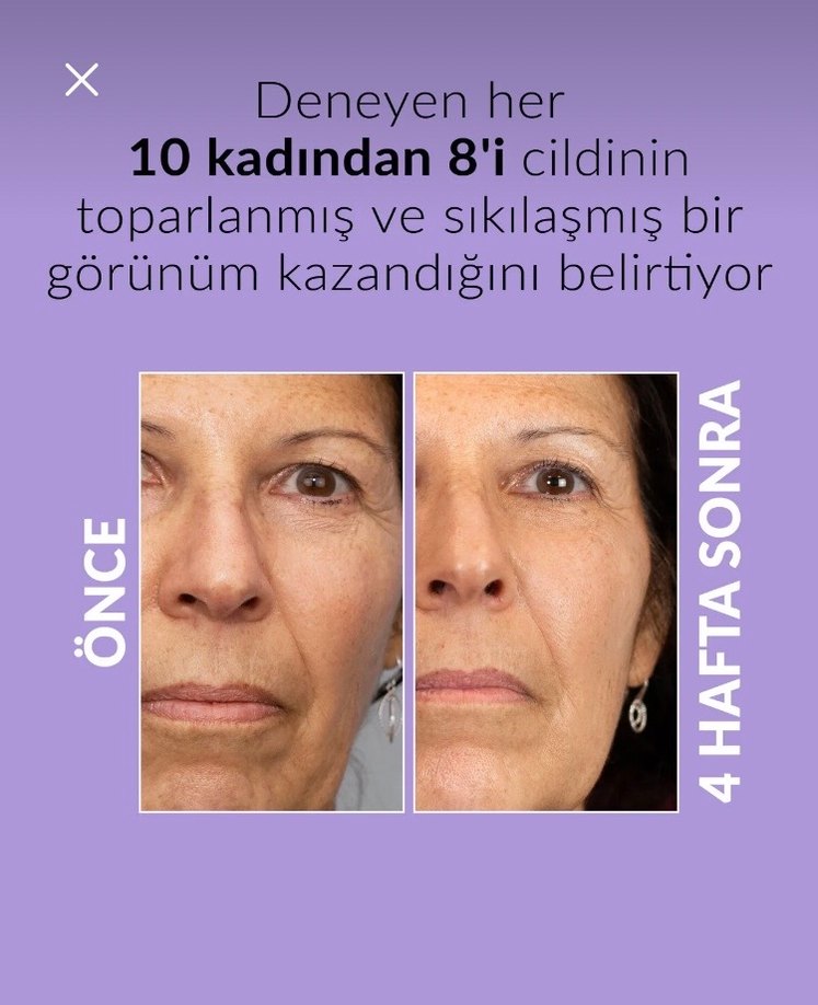 Anew Platinum Lifting ve Sıkılaştırıcı Serum - Görsel 3