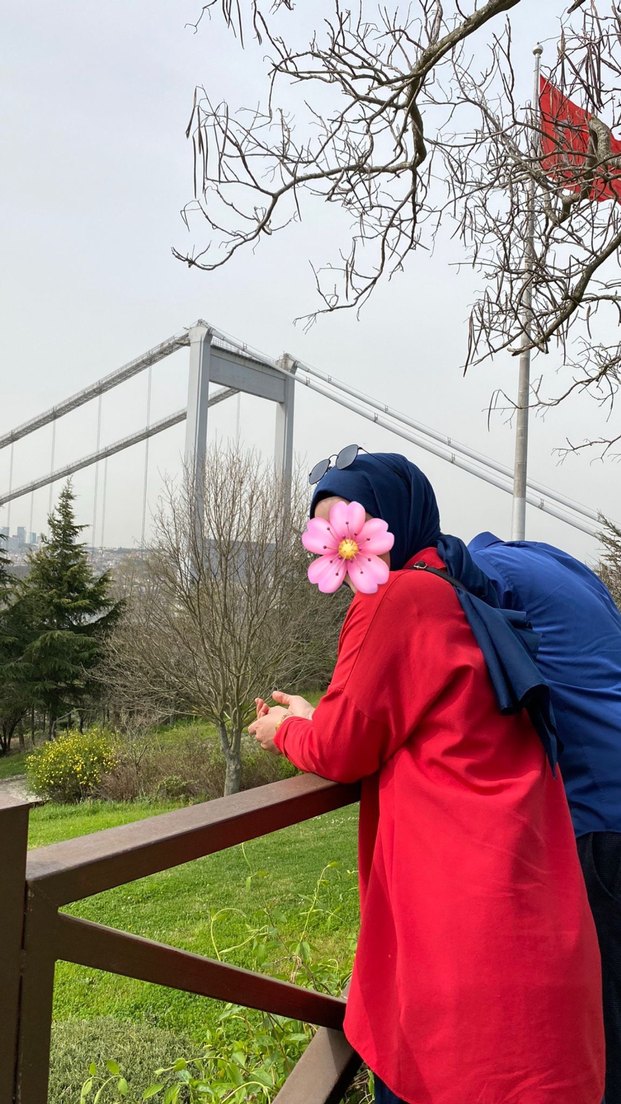 Kırmızı Düğmeli Salaş Midi Kadın Gömlek - Görsel 3