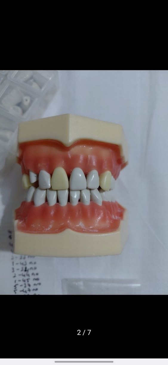 fuji çene - Görsel 2