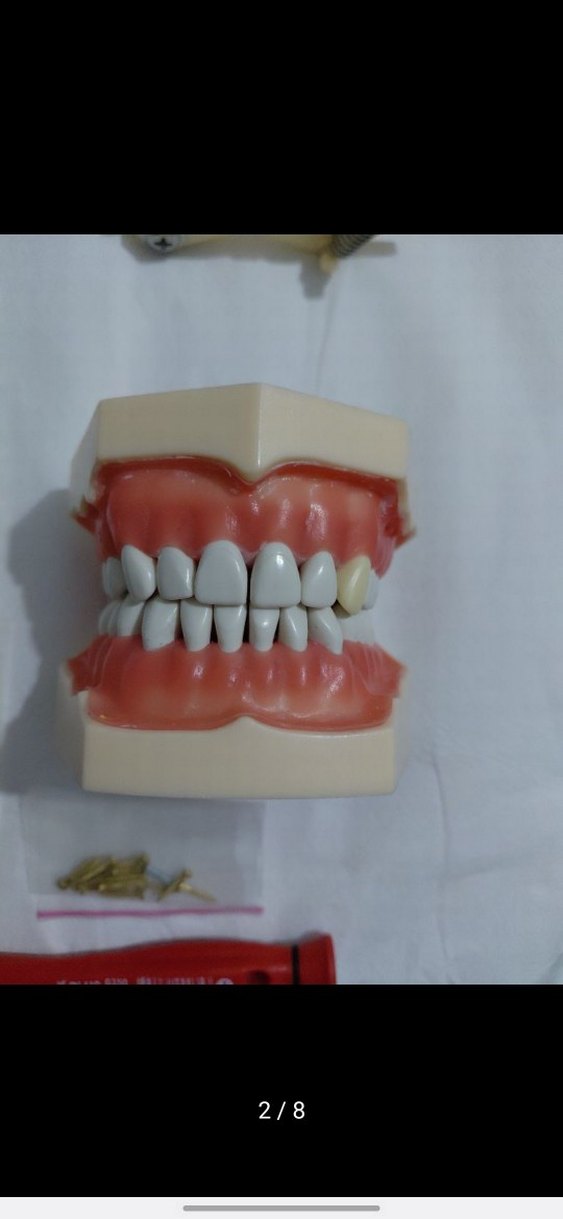 Diş Modeli Eğitim Kiti - Görsel 2