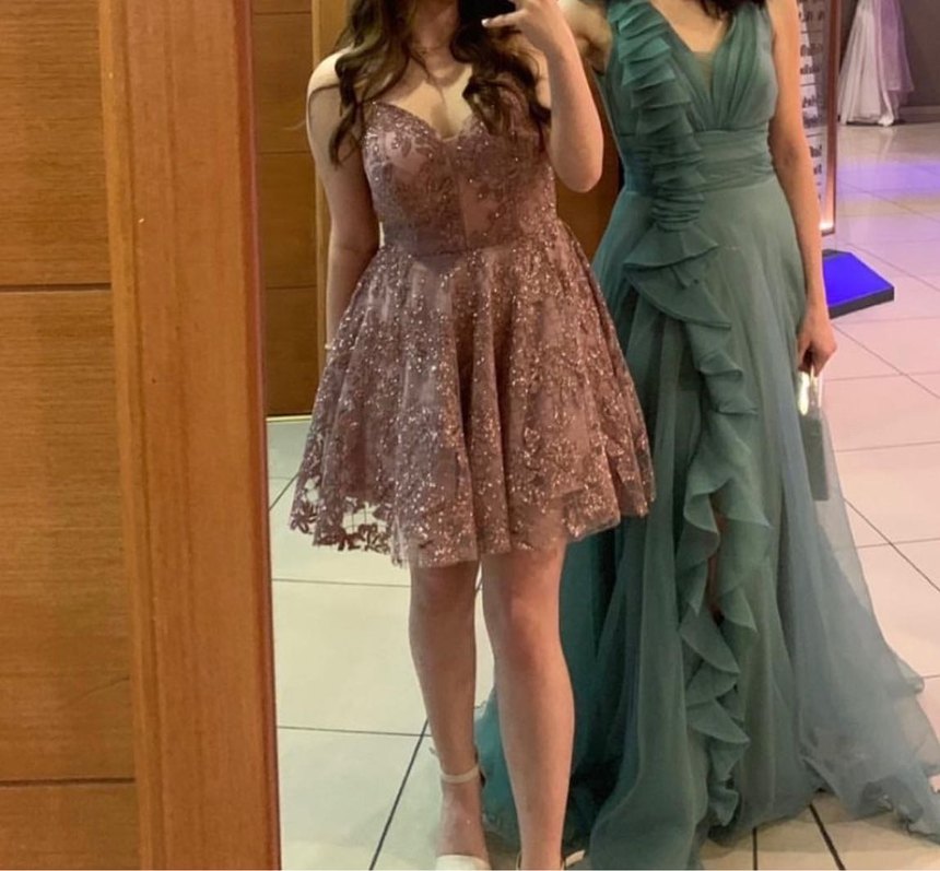 Nakışlı V Yaka Midi Dantel Elbise - Görsel 3