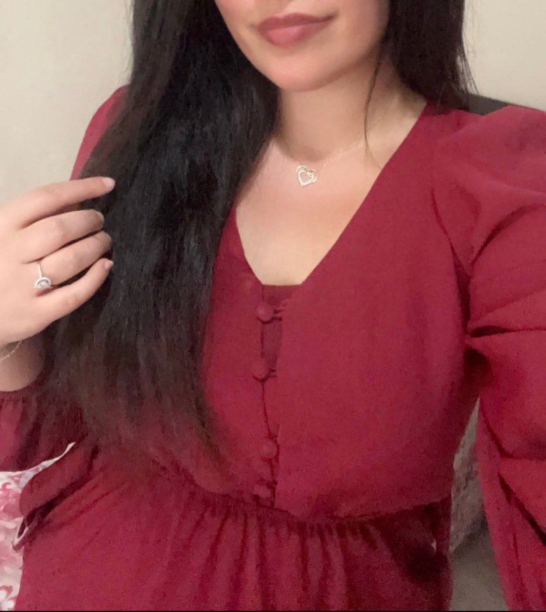 Düğmeli Midiboy Elbise - Görsel 2