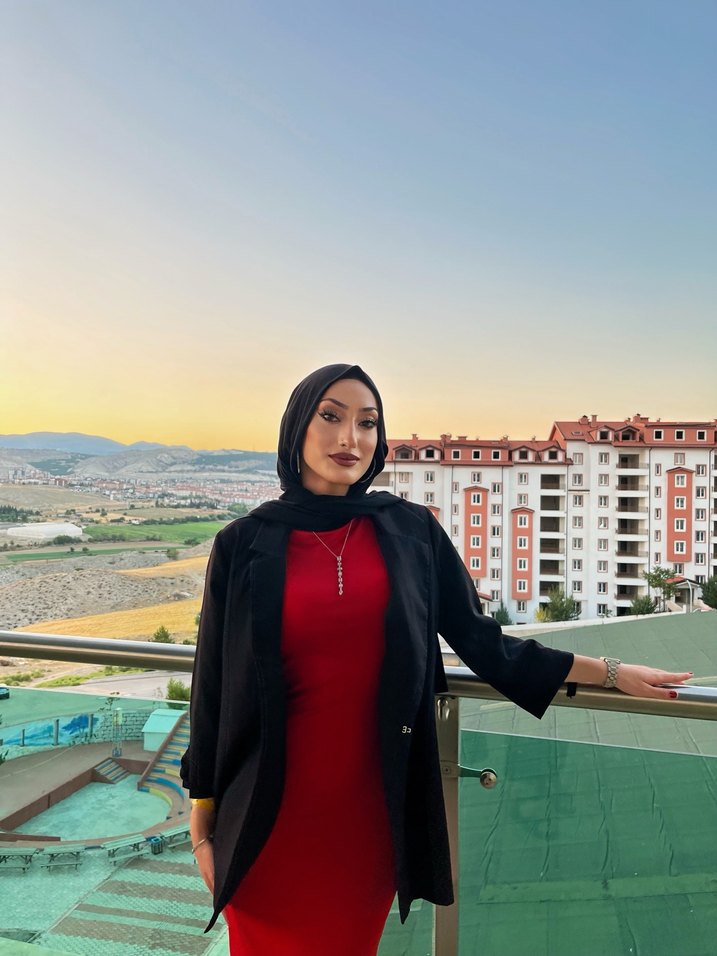 Kırmızı kısa kollu elbise - Görsel 2