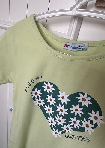 Yeşil Baskılı Kız Çocuk Elbise - Görsel 2