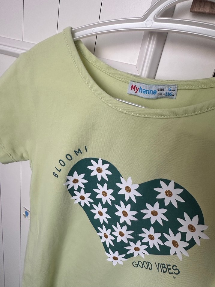 Yeşil Baskılı Kız Çocuk Elbise - Görsel 2